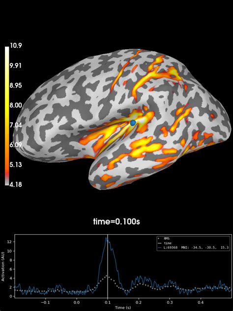 Eeg Source Localization Given Electrode Locations On An Mri Mne