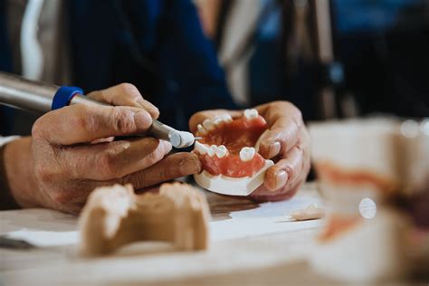 Puentes Dentales Qué son y qué tipos hay Clínica Dental KORESDENT