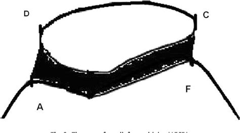 Figure 4 From The Effects Of Vacuumic Bracing System On The