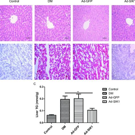 Effects On Histology And Tg Of Liver Of Hfdstz Induced Diabetic Rats