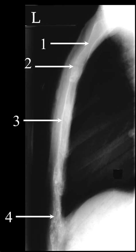 Radiographic Essentials 3 Lateral Sternum Diagram Quizlet