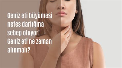 Geniz eti büyümesinin belirtileri nelerdir Geniz eti ne zaman alınmalı