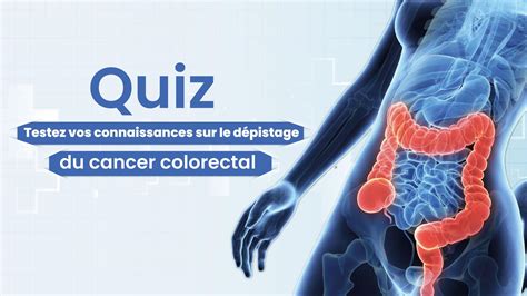 Quiz Testez Vos Connaissances Sur Le D Pistage Du Cancer Colorectal