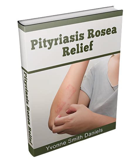 Pityriasis Rosea Treatment