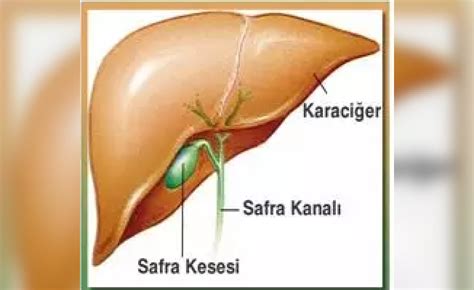 Safra Kesesi Ameliyat