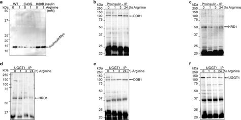 Arginine Switches Proinsulin Associated E3 Ubiquitin Ligases From HRD1