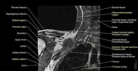 Brachial Plexus Mr Normal Anatomy E Anatomy