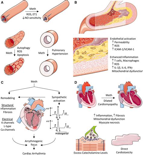 Methamphetamine Use And Cardiovascular Disease Arteriosclerosis