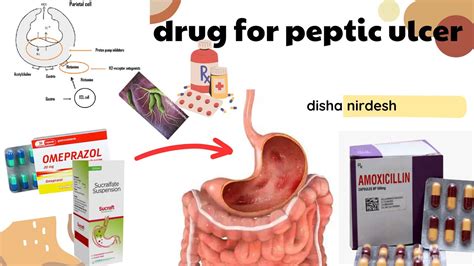 Peptic Ulcer Drug Antacid Medicine Nursing Disha Nirdesh Youtube