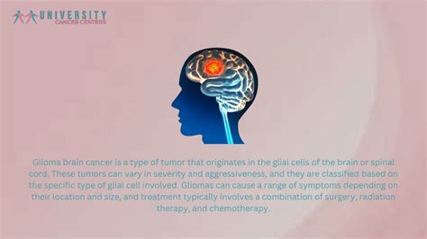 Ppt Glioma Brain Cancer Types Symptoms Causes Powerpoint