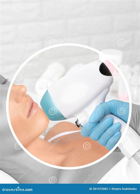 Elos Epilation Hair Removal Procedure On The Face Of A Woman