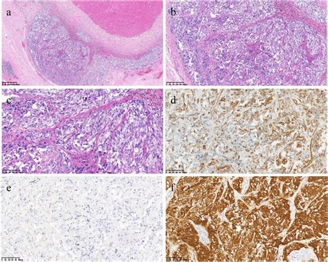 Histopathological Findings And Immunohistochemical Staining A Download Scientific Diagram