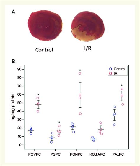 Changes In Oxpl Levels During Rat Coronary Ligation Ir Injury A Ttc