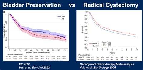 Asco 2024 Bladder Sparing Treatment Strategies For Localized