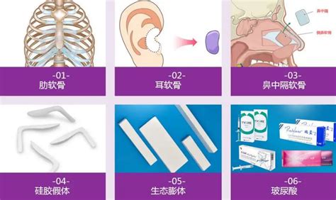 隆鼻材料要怎么选？国内做隆鼻比较好的医生有哪些？需要多少钱呢？ 知乎