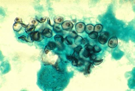 Dimorphic Fungi Life Worldwide