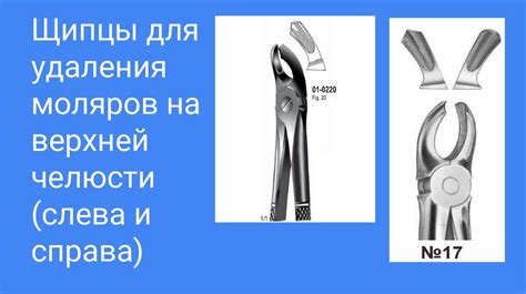 Инструменты для удаления зубов на верхней и нижней челюсти ...