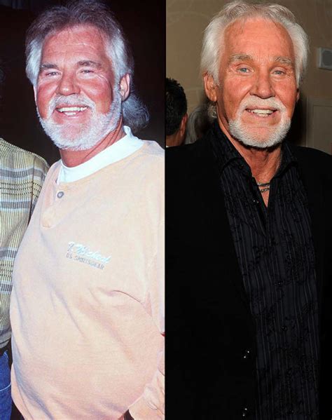 Kenny Rogers Before And After