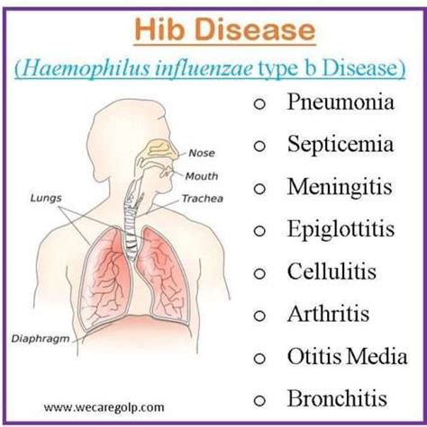 Hib Disease(Haemophilus influenzaeType b Disease) - We Care