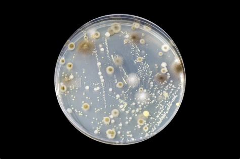 Colonies Of Different Bacteria And Mold Fungi Grown On Nutrient Agar