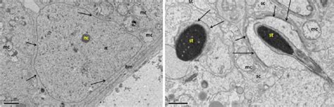 Electron Micrograph Tem Of Sertoli Cell From Group C Cryopreserved