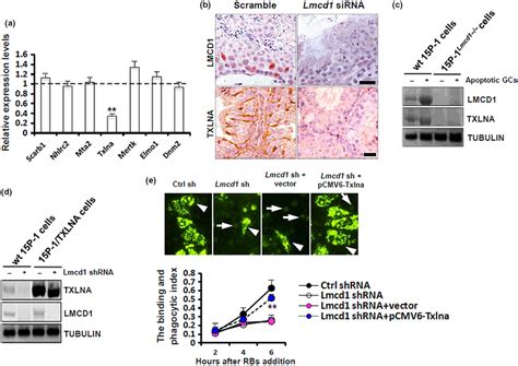 Lmcd1 Depletion Compromises Txlna‐mediated Testicular Phagocytosis A