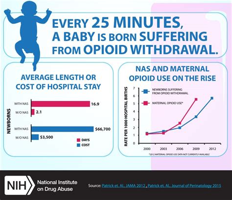 Born Addicted Neonatal Abstinence Syndrome Trends In Neonatal