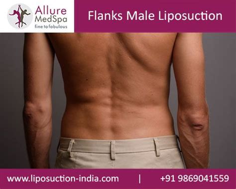 Pin On Liposuction