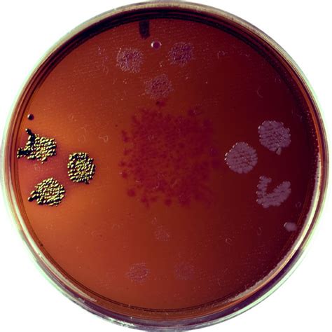 Bacillus Cereus Nutrient Agar