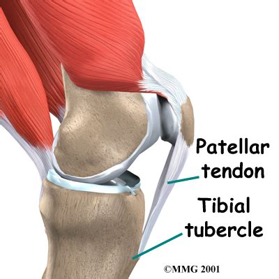 Physical or Occupational Therapy in Cleveland for ACL Patellar Tendon Graft Reconstru