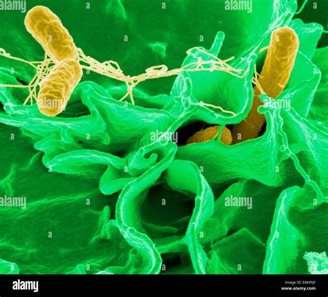 Salmonella Bacteria A Common Cause Of Food Poisoning Invade An Stock