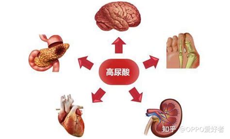 降尿酸是什么？生活中如何通过饮食改善降尿酸？ 知乎