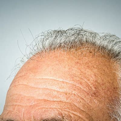 Coaxing Hair Growth In Aging Hair Follicle Stem Cells Statnano