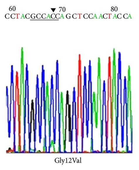 K Ras Genotype In Crc A K Ras Wild Type B Representative Example