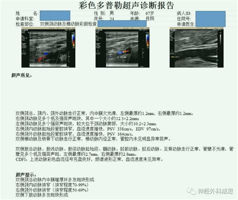 颈动脉斑块 一文读懂颈动脉超声报告 健康160