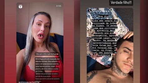 Andressa Urach Faz Novo Procedimento Ap S Dividir L Ngua Ao Meio