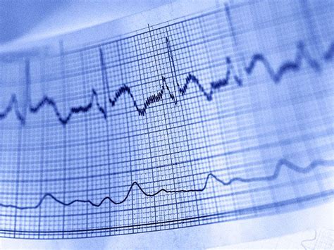 Heart Tests Types Uses And When To Contact A Doctor