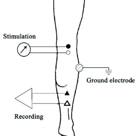 Location Of The Stimulating And Recording Electrodes Of The Soleus