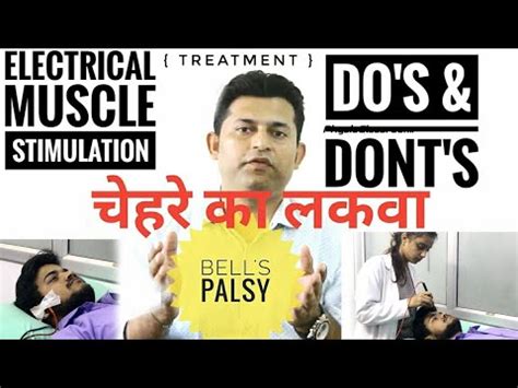 Electrical Muscle Stimulation In Bell S Palsy Youtube