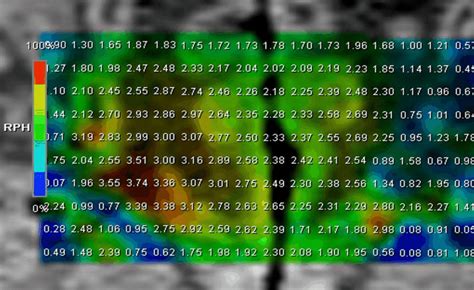 MR spectroscopy matrix quantifying the concentrations of brain ...