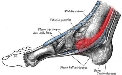 Posterior Tibial Tendonitis Swelling