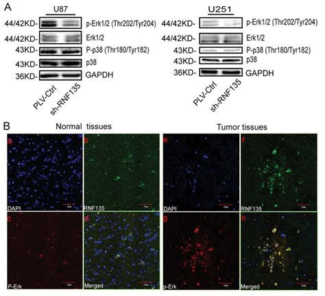 Western Blotting And Immunofluorescence Double Labelling Assay