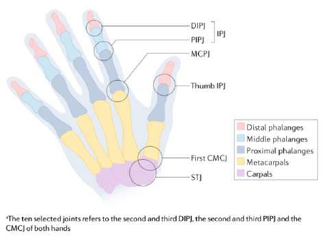 Hand Osteoarthritis