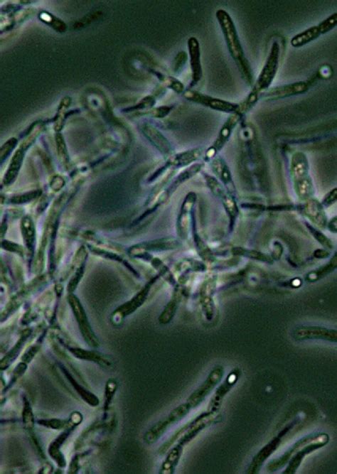 Free picture: bacillus anthracis, endospores, phase, contrast, microscopy