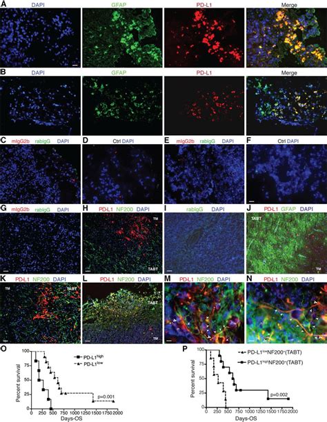 Pd L1 Expression By Neurons Nearby Tumors Indicates Better Prognosis In