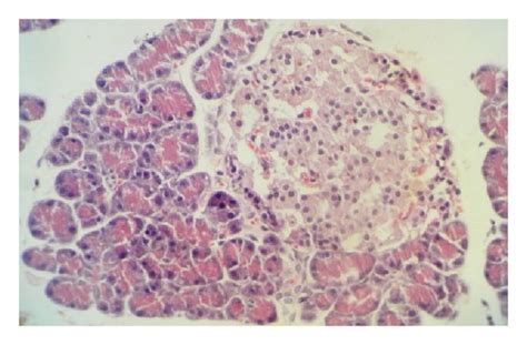 A D Photomicrographs Of Histopathology Of The Pancreatic Tissues Download Scientific Diagram