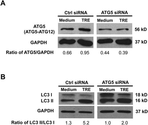 Knockdown Of Autophagy Related Gene 5 Atg5 Inhibits Trehalose Induced Download Scientific