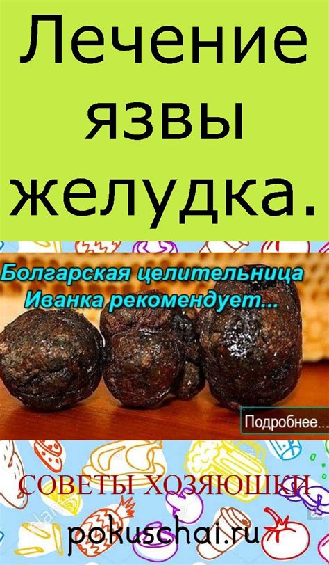 Лечение язвы желудка.