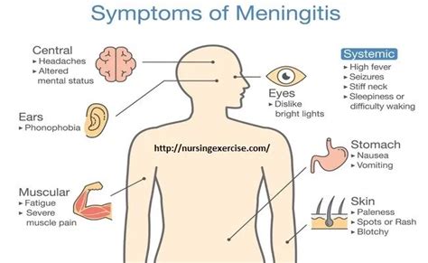 Meningitis Symptoms Diagnosis And Complications Meningitis Severe Headache Migraine Headaches