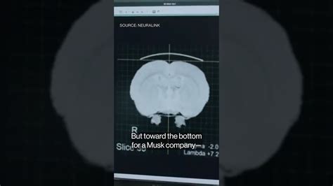 Would You Let Elon Musks Neuralink Put A Chip In Your Brain